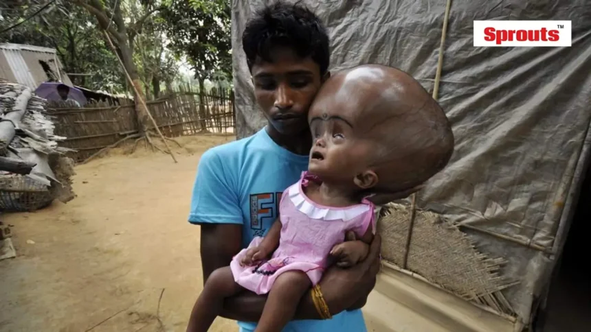 MP Infant Deaths led DARPG Seeks Accountability from NHM Officials