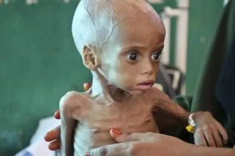 Malnutrition Nightmare Near Mumbai 163 Affected, 9 Critical