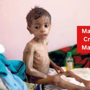 Malnutrition Crisis Grips Maharashtra Stark Warning for Government.